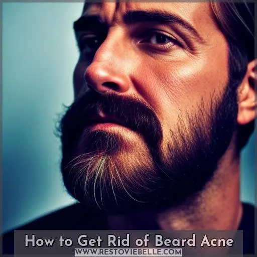 How to Get Rid of Beard Acne