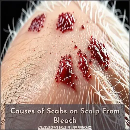 Causes of Scabs on Scalp From Bleach