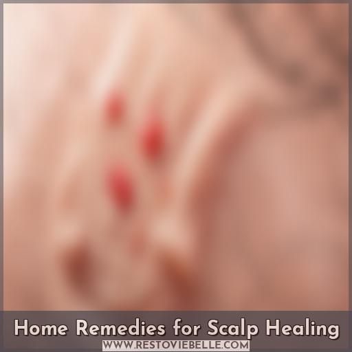 Home Remedies for Scalp Healing