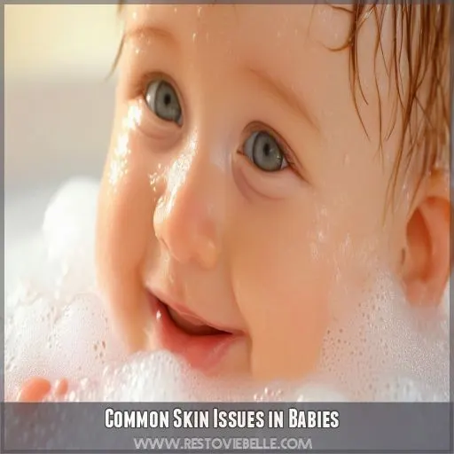 Common Skin Issues in Babies