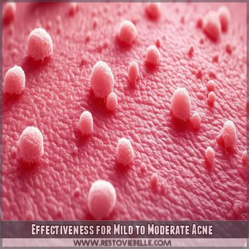 Effectiveness for Mild to Moderate Acne