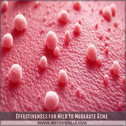 Effectiveness for Mild to Moderate Acne