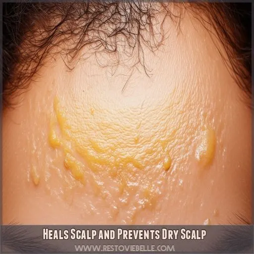 Heals Scalp and Prevents Dry Scalp