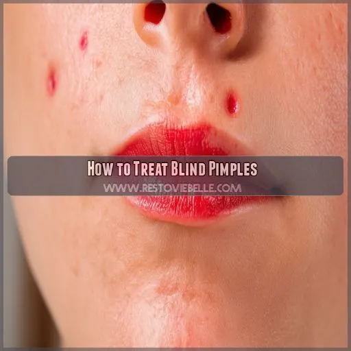 How to Treat Blind Pimples