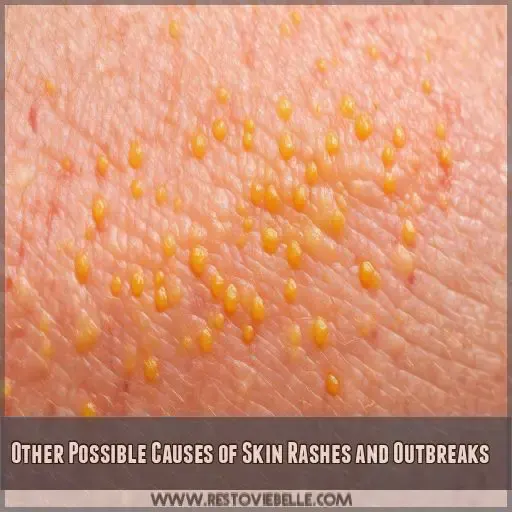 Other Possible Causes of Skin Rashes and Outbreaks