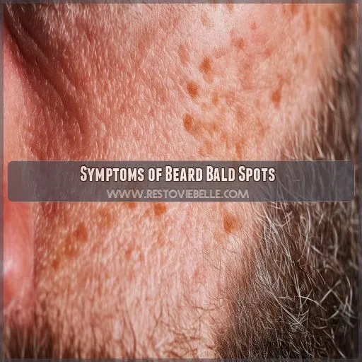 Symptoms of Beard Bald Spots
