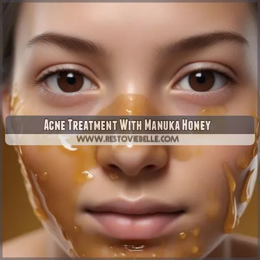 Acne Treatment With Manuka Honey