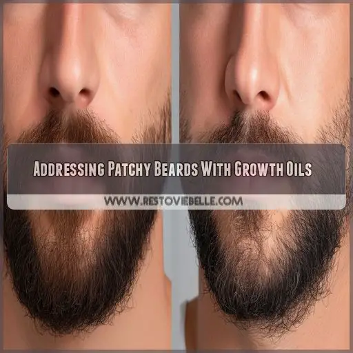 Addressing Patchy Beards With Growth Oils