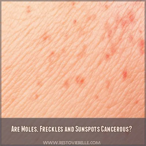 Are Moles, Freckles and Sunspots Cancerous