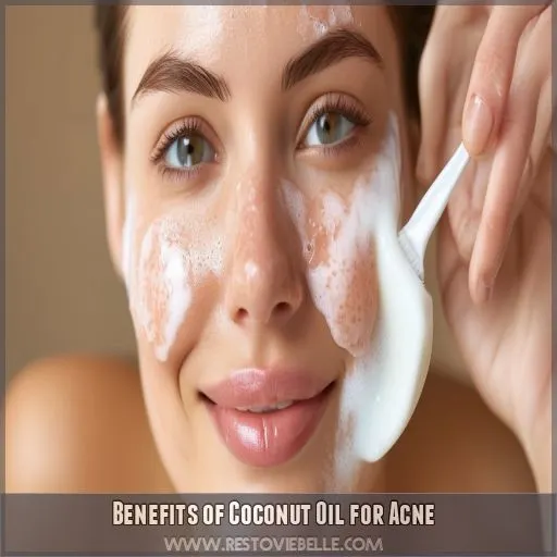 Benefits of Coconut Oil for Acne