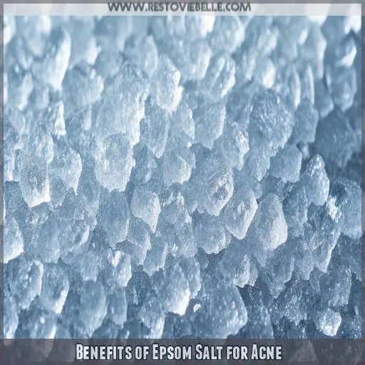 Benefits of Epsom Salt for Acne