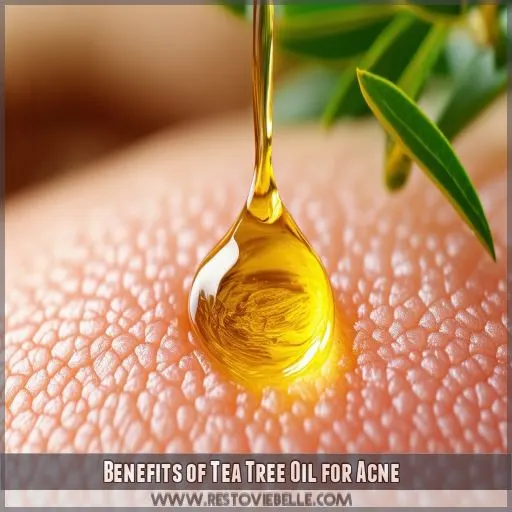 Benefits of Tea Tree Oil for Acne