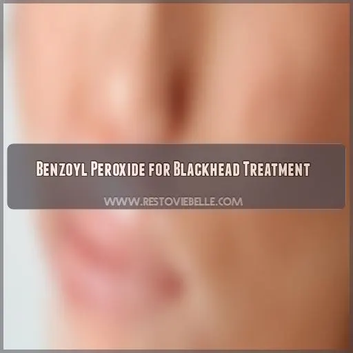 Benzoyl Peroxide for Blackhead Treatment