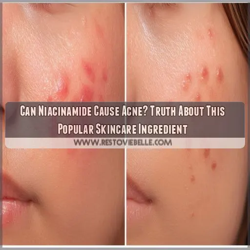 can niacinamide cause acne