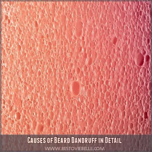 Causes of Beard Dandruff in Detail
