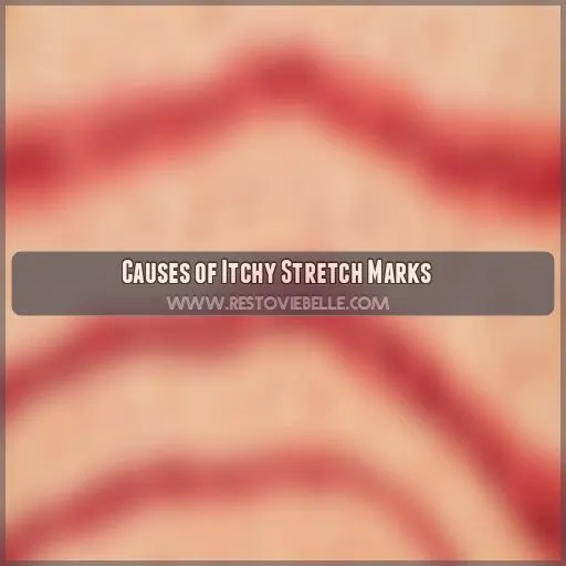 Causes of Itchy Stretch Marks