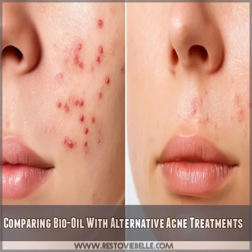 Comparing Bio-Oil With Alternative Acne Treatments