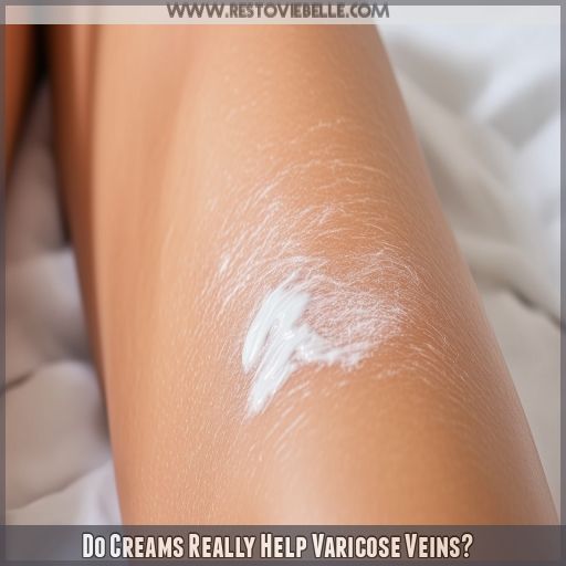 Do Creams Really Help Varicose Veins