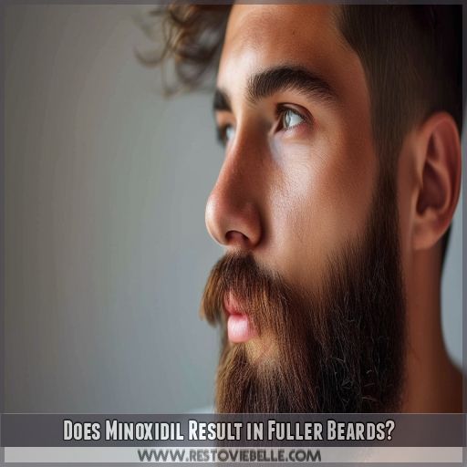 Does Minoxidil Result in Fuller Beards