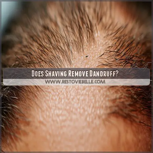 Does Shaving Remove Dandruff