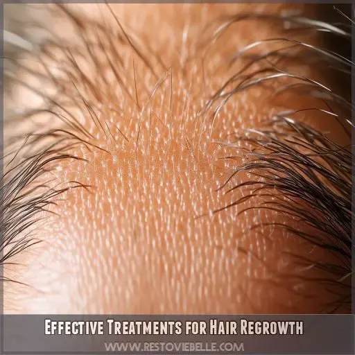 Effective Treatments for Hair Regrowth