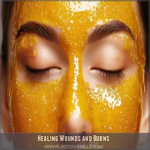 Healing Wounds and Burns