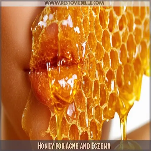 Honey for Acne and Eczema