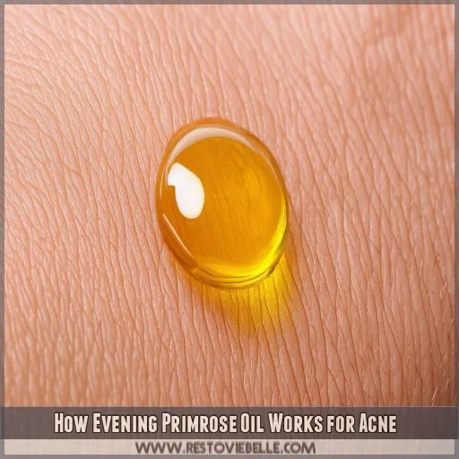 How Evening Primrose Oil Works for Acne