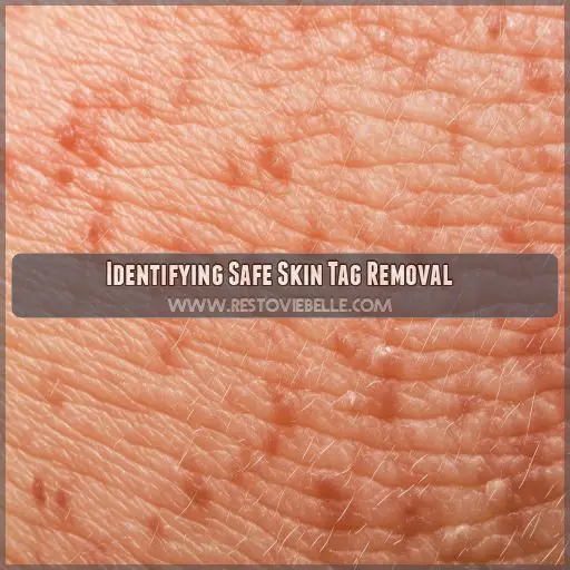 Identifying Safe Skin Tag Removal