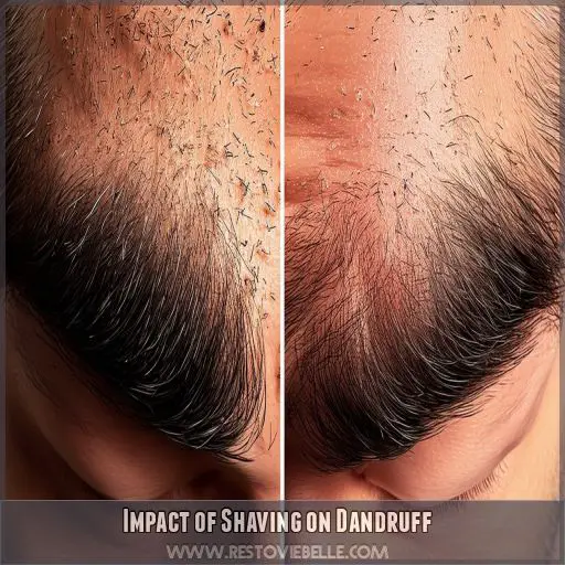 Impact of Shaving on Dandruff