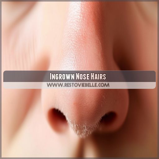 Ingrown Nose Hairs