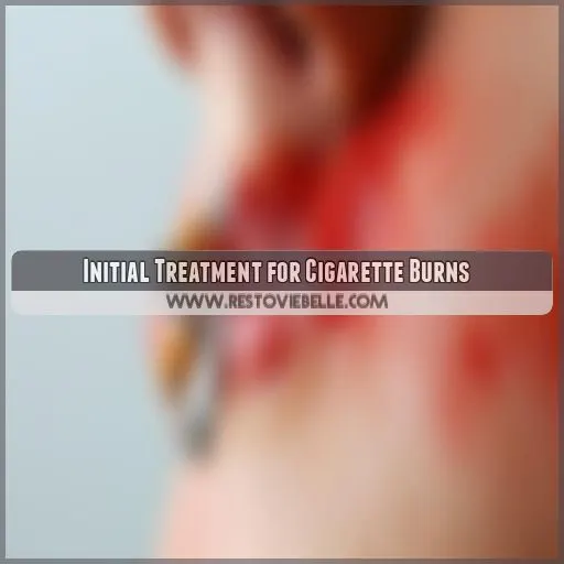 Initial Treatment for Cigarette Burns