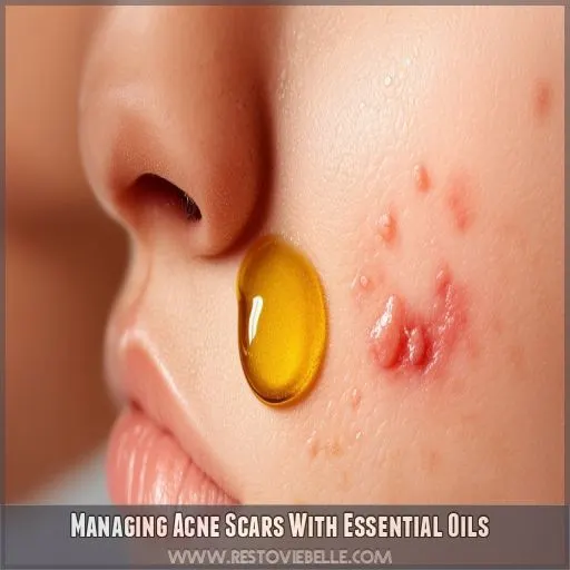 Managing Acne Scars With Essential Oils