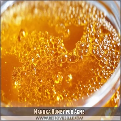 Manuka Honey for Acne