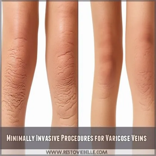 Minimally Invasive Procedures for Varicose Veins