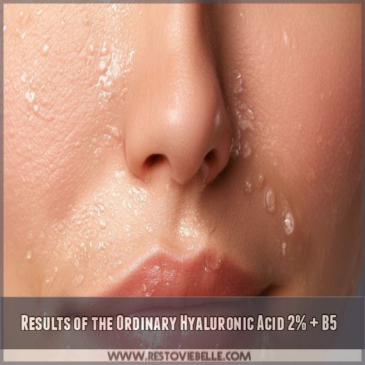 Results of the Ordinary Hyaluronic Acid 2% + B5