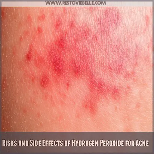 Risks and Side Effects of Hydrogen Peroxide for Acne