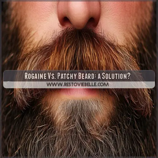 Rogaine Vs. Patchy Beard: a Solution