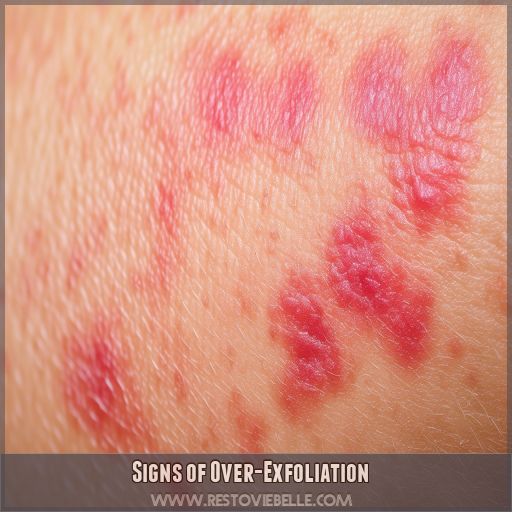 Signs of Over-Exfoliation