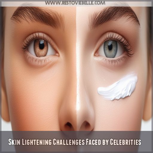 Skin Lightening Challenges Faced by Celebrities