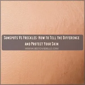 sunspots vs freckles