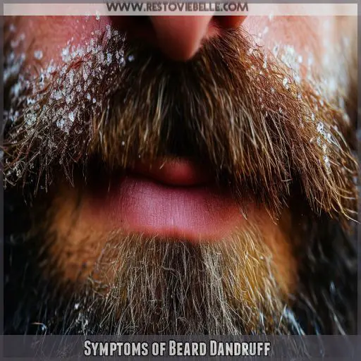 Symptoms of Beard Dandruff