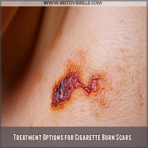 Treatment Options for Cigarette Burn Scars