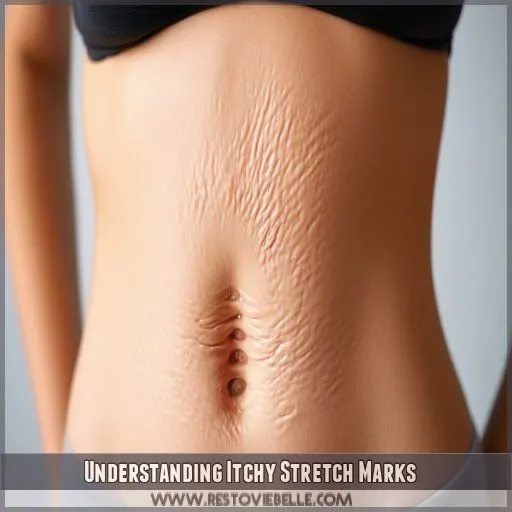 Understanding Itchy Stretch Marks