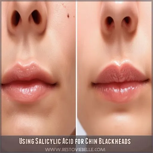 Using Salicylic Acid for Chin Blackheads