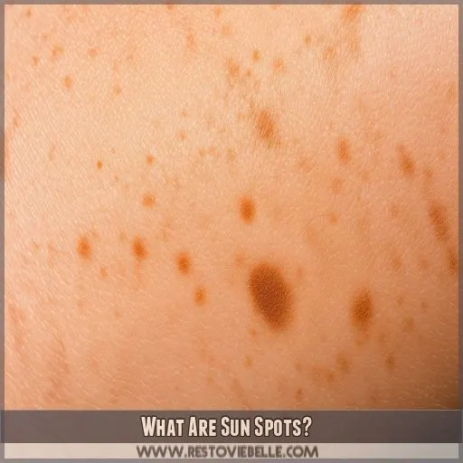 What Are Sun Spots