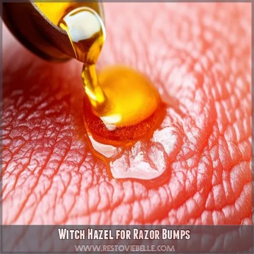 Witch Hazel for Razor Bumps