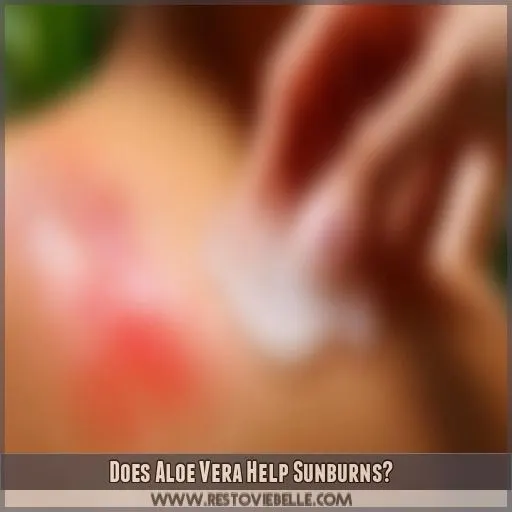 Does Aloe Vera Help Sunburns