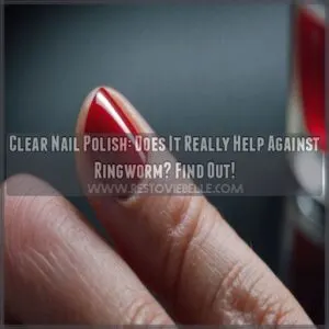 does clear nail polish help ringworm