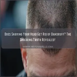 does shaving your head get rid of dandruff